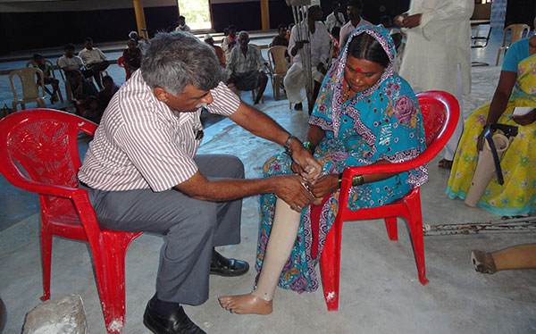 Artificial Limb Distribution